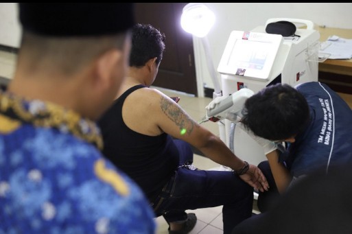 Seratus Warga Jakut Manfaatkan Layanan Gratis Hapus Tato